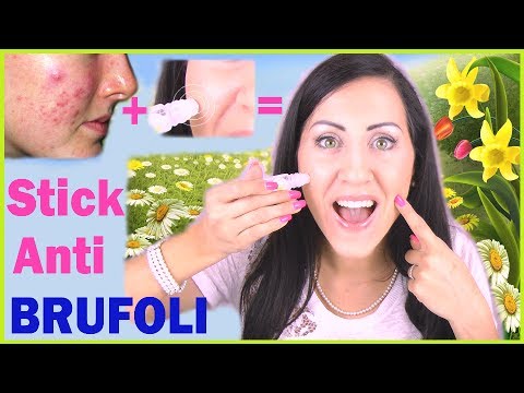 Integratori alimentari per aumentare la potenza e aumentare la forza muscolare Come aumentare il metodo nazionale del pene