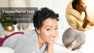 Excess Facial Hair In women | Causes| Treatments | My Experience