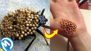 CUIDADO COM ESSAS MORDIDAS DE INSETO