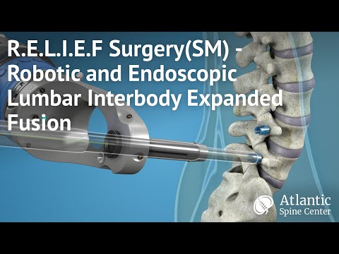 RELIEF Surgery℠