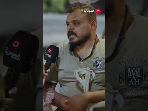شاهد بالفيديو.. أكثر من بنية رفضتني بسبب رجلي #shorts