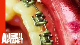 How Orthodontic Braces Nearly Killed A Teenager | Monsters Inside Me