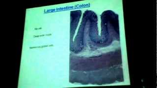Dr Gihan Data show 3 " Intestine - Appendix - Salivary glands."