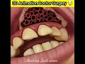 3D Animation Doctor Infection Surgery Shorts Viral