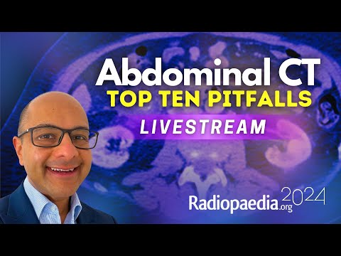 Top ten pitfalls in abdominal CT with Vikas Shah