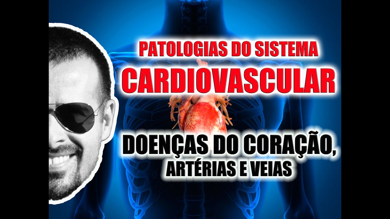 Doenças do Coração, Artérias e Veias - Patologias do Sistema Cardiovascular - VideoAula 065