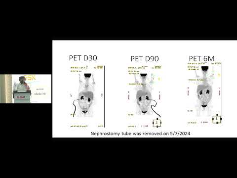 CAR-T vs Bispecific Antibodies in Aggressive Lymphoma | Sameer Alamoudi | 30 JAN 2026