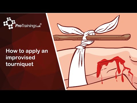 How to apply an improvised tourniquet