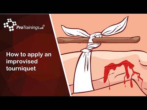 How to Apply a Tourniquet