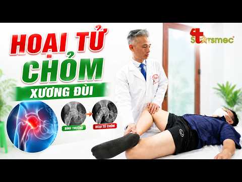 Hoại Tử Chỏm Xương Đùi: Đừng Đợi Đến Khi Đau Không Đi Nổi!