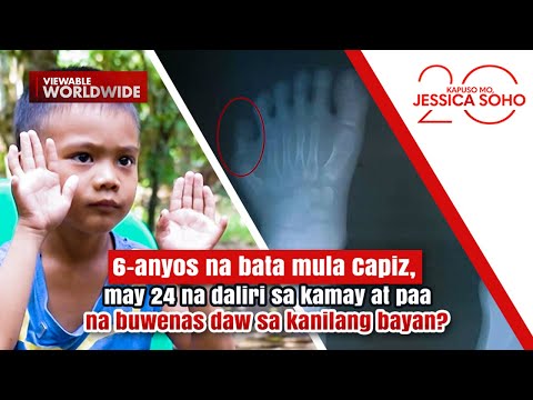Bata, may 24 na daliri sa kamay at paa na buwenas daw sa kanilang bayan? | Kapuso Mo, Jessica Soho
