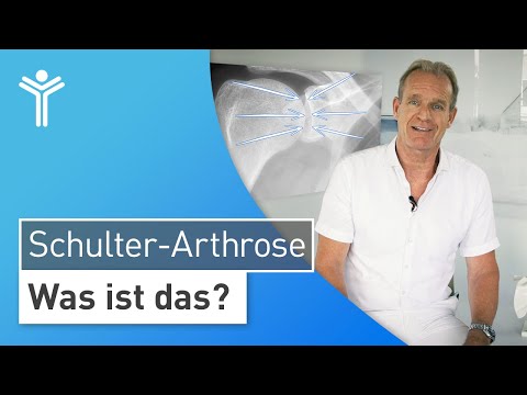 Shoulder osteoarthritis: What is shoulder osteoarthritis and how does joint wear occur?