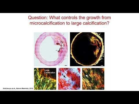 Cardiovascular Mechanics and Extracellular Vesicles