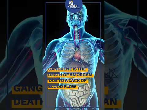 What is gangrene & how to prevent it? | Apollo Hospitals