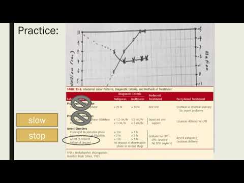 Plotting and Interpreting Abnormal Labor curves