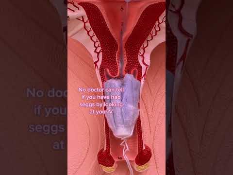 Can you lose your virginity with a tampon? #shorts