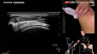 Session 3 – Diagnostic Shoulder Exams: Posterior Shoulder
