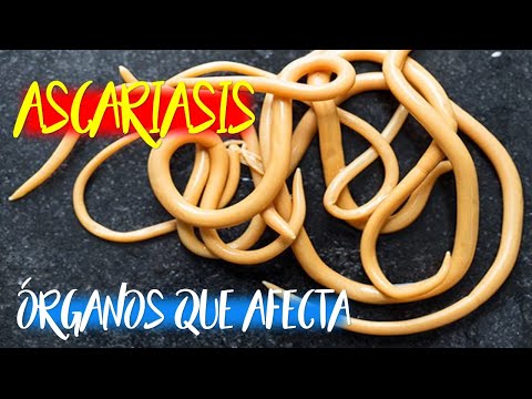 Ascariasis Laika Liker- től