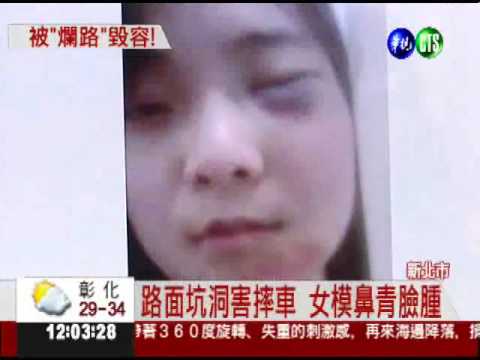 爛路害她毀容... 女模聲請國賠