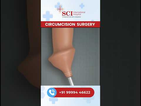 Circumcision Surgery – Modern, Painless Method #circumcision #painless