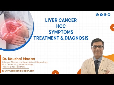 Liver Cancer| HCC| Symptoms| Treatment & Diagnosis| Dr Kaushal Madan |Hepatologist |Gastroenterology