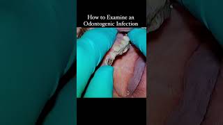 Vestibular Abscess. Oral Exam of Infection