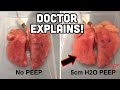 P E E P In 90 Seconds DOCTOR Explains