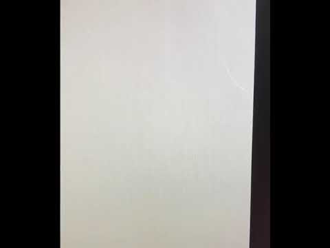 Angioplastia vena iliaca