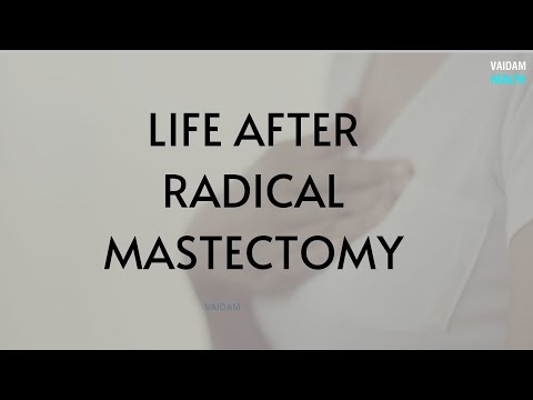 Life after Radical Mastectomy