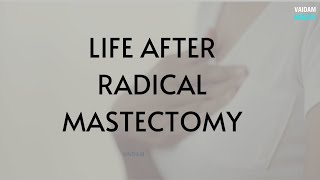 Life after Radical Mastectomy