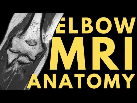 Elbow MRI Anatomy | Radiology anatomy part 1 prep | How to interpret an elbow MRI