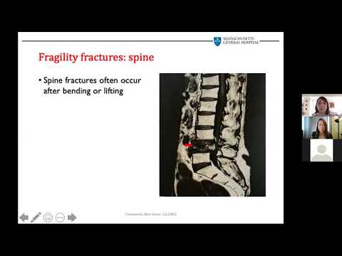 Blum Center Program: Are Your Bones Strong?