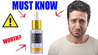 SKIN BIOTIX MD REVIEW - WATCH 10X! Does Skin Biotix MD Work? Skin Biotix MD Skin Tag Remover Reviews