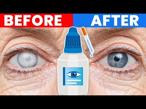 How To Get Rid of Eye Floaters – Dr Berg On Eye Floater Treatment