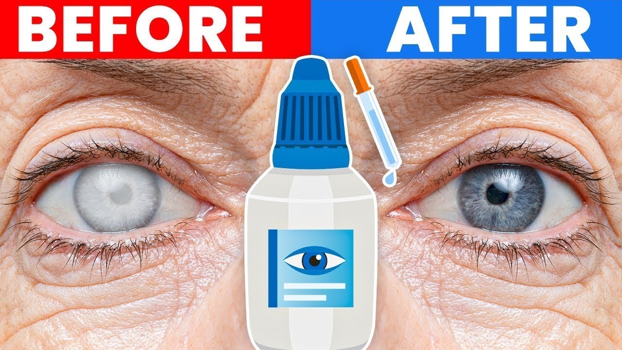 Ultimate Support for Your Cataracts