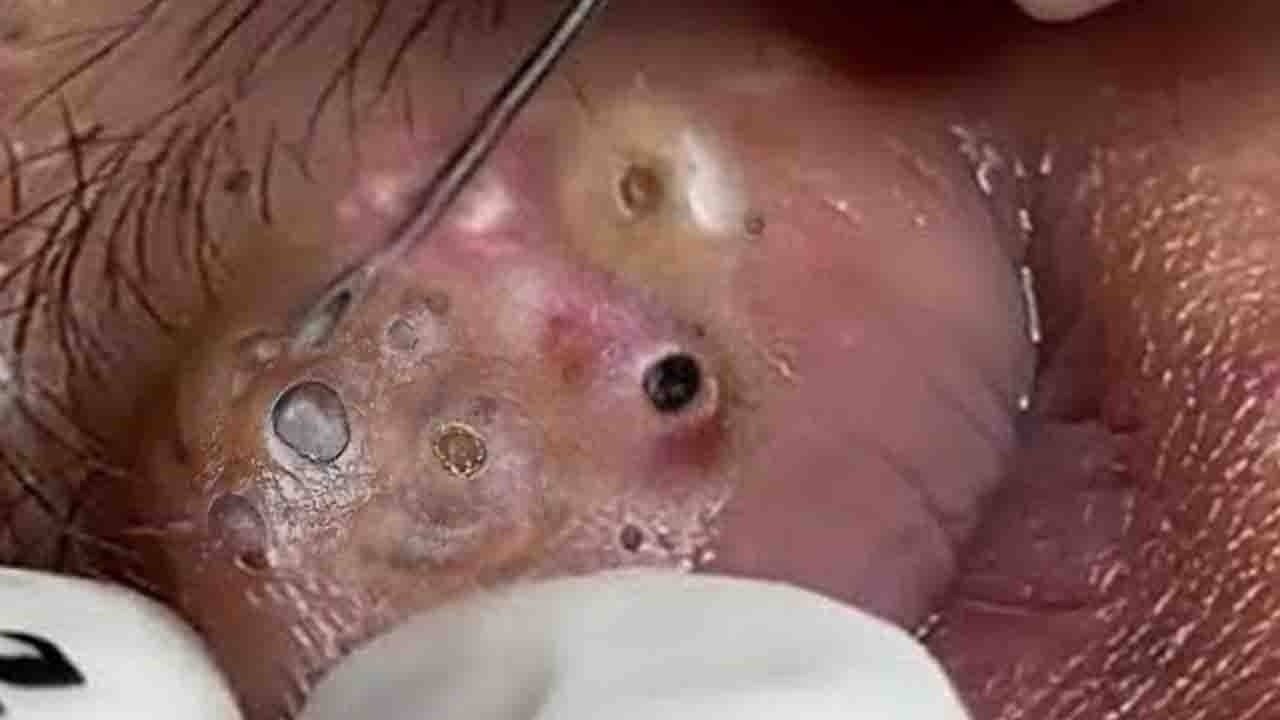 𝑺𝒐𝒐𝒕𝒉𝒊𝒏𝒈 𝑭𝒂𝒄𝒊𝒂𝒍 𝑻𝒓𝒆𝒂𝒕𝒎𝒆𝒏𝒕 𝑭𝒐𝒓 𝑺𝒕𝒓𝒆𝒔𝒔 𝑹𝒆𝒍𝒊𝒆𝒇 𝒂𝒕 𝑳𝒖𝒙𝒖𝒓𝒚 𝑺𝒑𝒂 𝑨𝒄𝒉𝒊𝒆𝒗𝒆 𝑰𝒏𝒏𝒆𝒓 𝑷𝒆𝒂𝒄𝒆 #32354