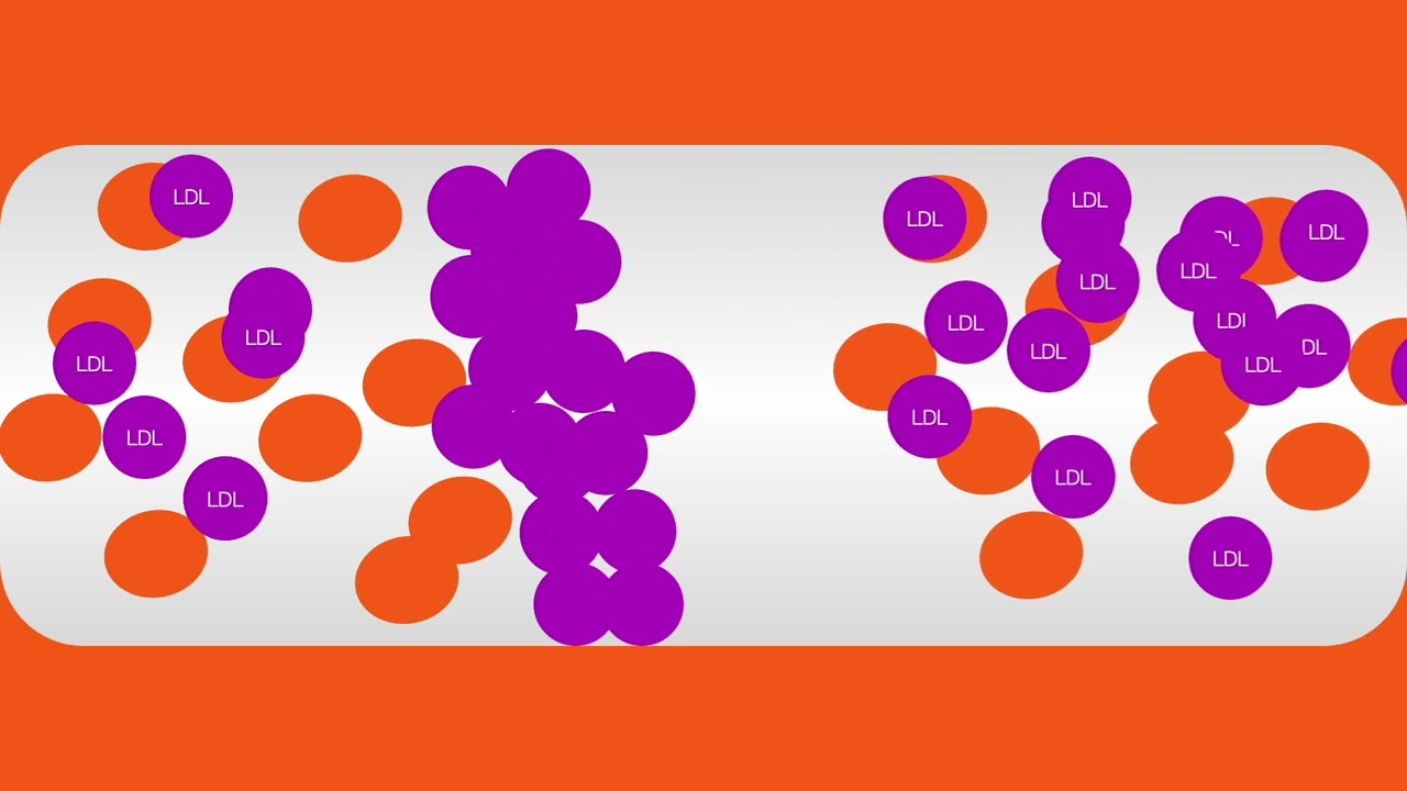 Aceite de Oliva y Esclerosis Múltiple