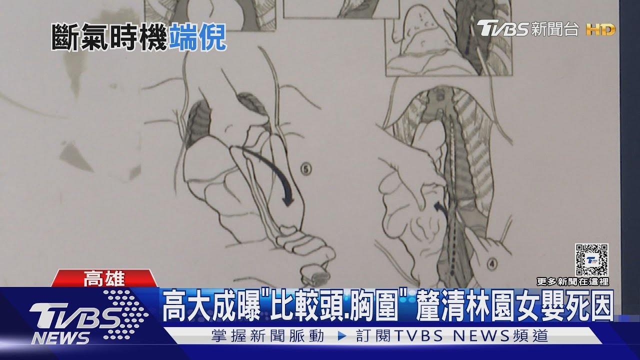 死後棄屍?遺棄致死 林園棄嬰案高大成曝關鍵:比較頭、胸圍