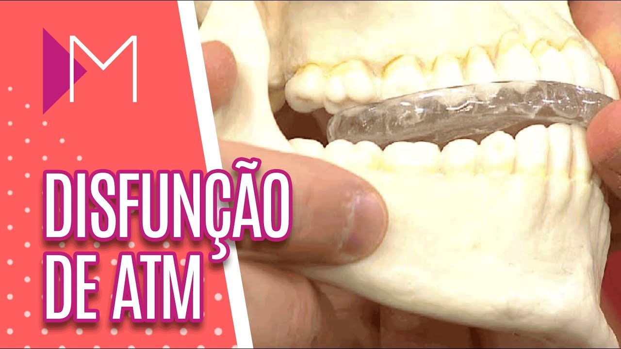 Disfunção da ATM - Mulheres (16/05/18)