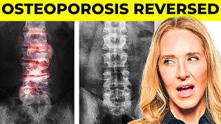 The simple exercise you’re missing for osteoporsosis
