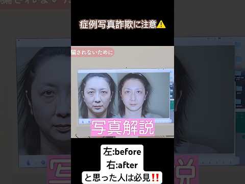 医学科 症例写真詐欺の見極め方