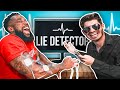 2HYPE Lie Detector Test Lie Shock