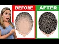 1 Product to Prevent Hair Loss and Regrow Your Hair!