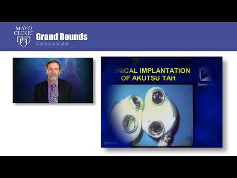 CV Grand Rounds – The Evolution of Mechanical Circulatory Support Devices