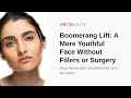 Boomerang Lift: A More Youthful Face Without Fillers or Surgery
