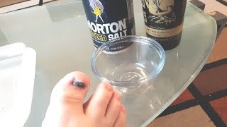 How HEAL Get Rid of Bruised Black TOENAIL Quickly Naturally at Home