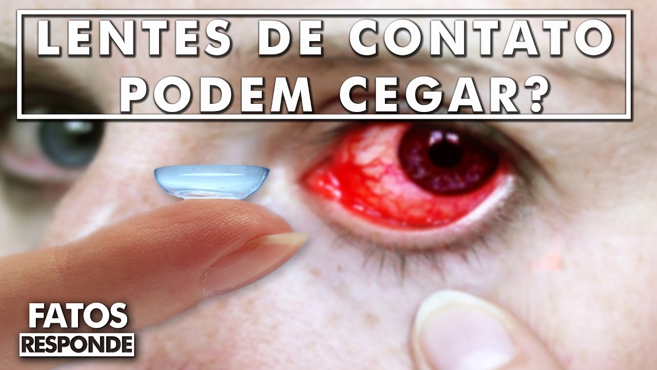 Watch Now Lentes de Contato podem Cegar - FATOS RESPONDE Lentes de Contato podem Cegar - FATOS RESPONDE