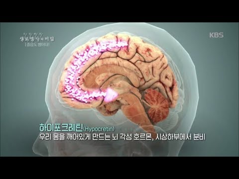 생로병사의 비밀 - 수면 장애가 졸음운전을 부른다.20170816