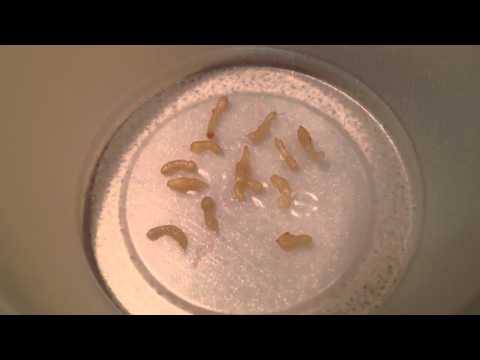 Dieta a parassiti di intestini Video di parassiti che vivo nella persona