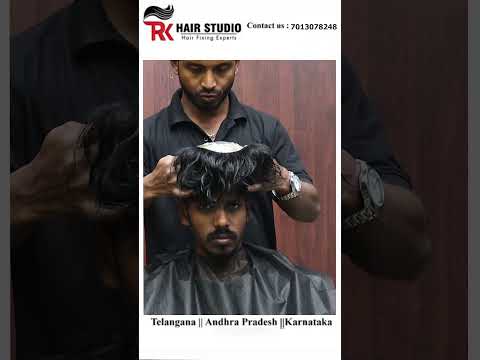 Hair patch transformation
